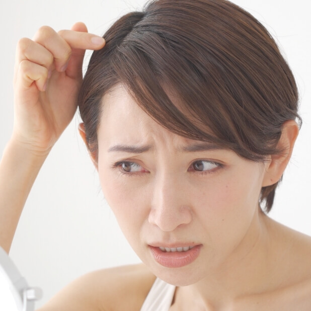 エイジングやアルカリ系薬液による髪・頭皮ダメージ / 薄毛・やせ髪に悩んでいる女性が多い